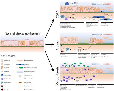 Epithelial Barrier Dysfunction in Chronic Respiratory Diseases